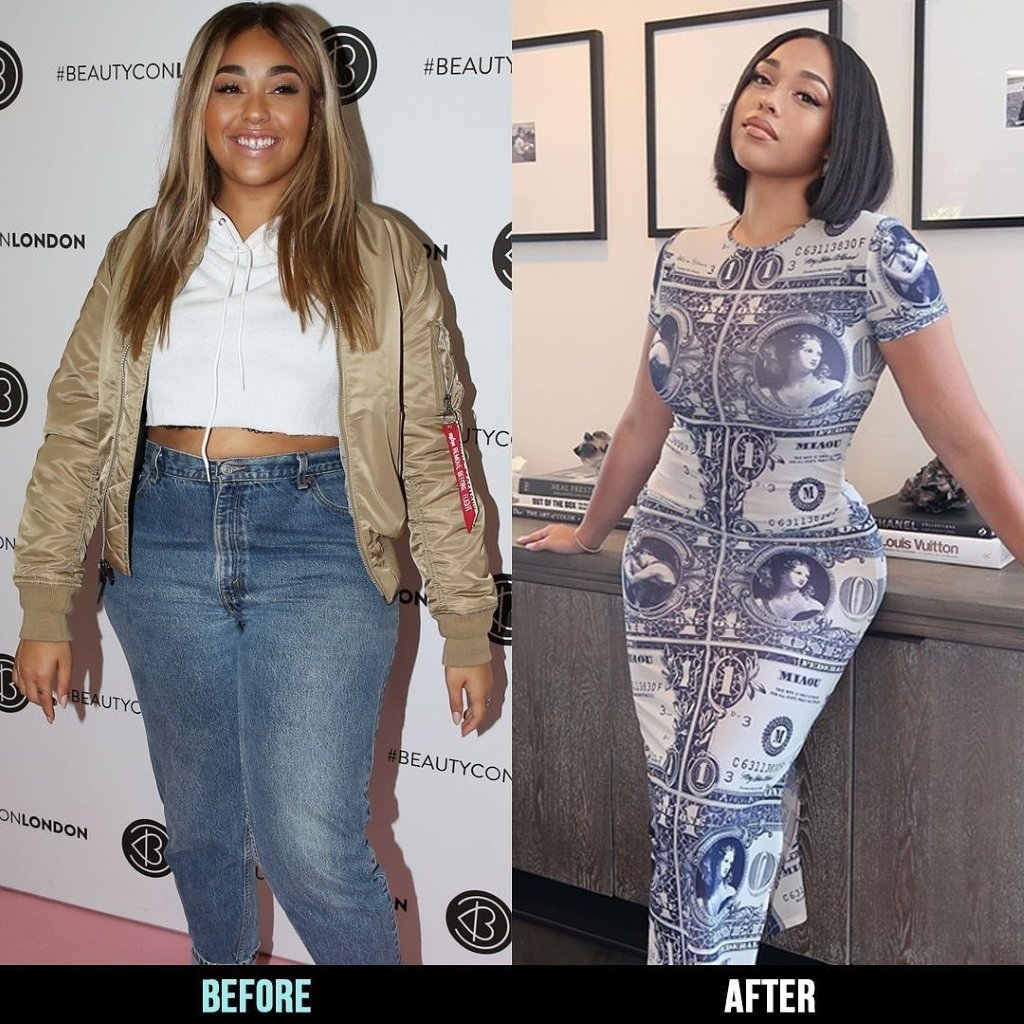 Jordyn Woods before and after photos